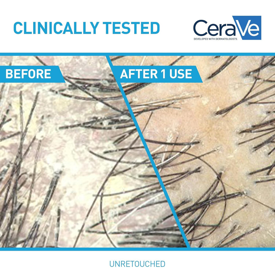 CeraVe Hydrating Anti Dandruff Conditioner