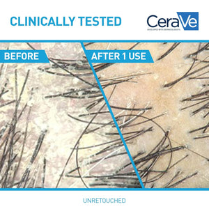 CeraVe 2 In 1 Hydrating Anti Dandruff Shampoo And Conditioner
