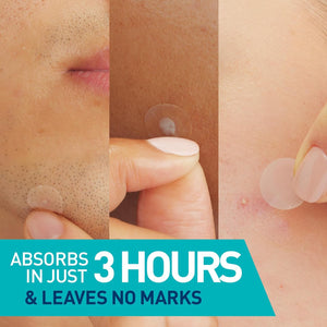 Hydrocolloid Blemish Patches
