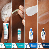 CeraVe Acne Skin Care Set